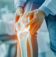 Orthopaedic surgeon examining a knee X-ray